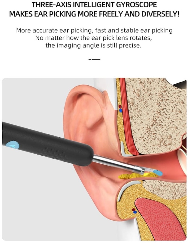 dissolvant de cérumen avec caméra nettoyant les oreilles